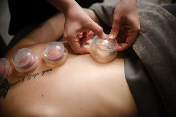 applied cups cupping