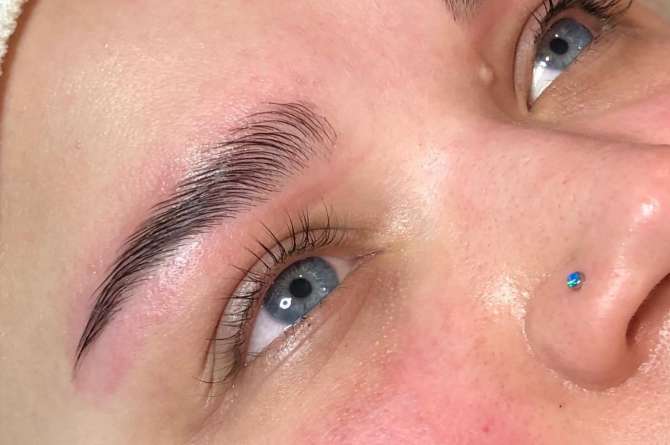 Image of eyebrows being treated