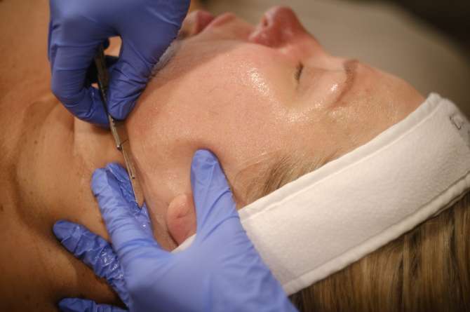 Image of patient receiving dermaplaning treatment on skin.