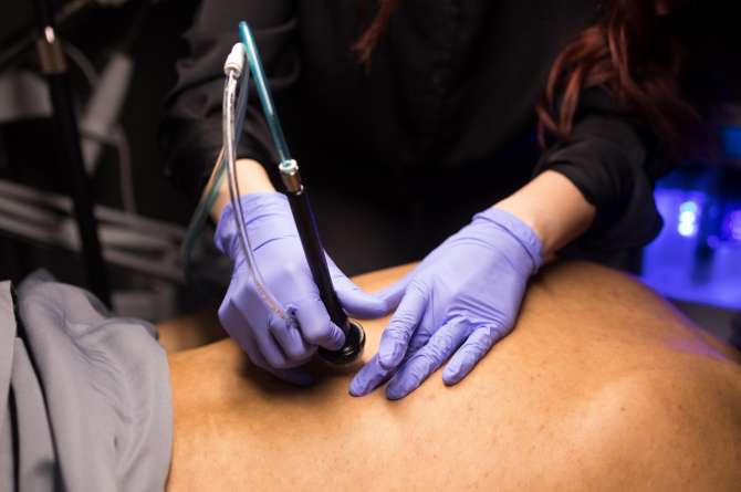 Diamond Glow treatment performed male back