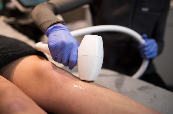 Inmode Diolaze Laser Hair Removal